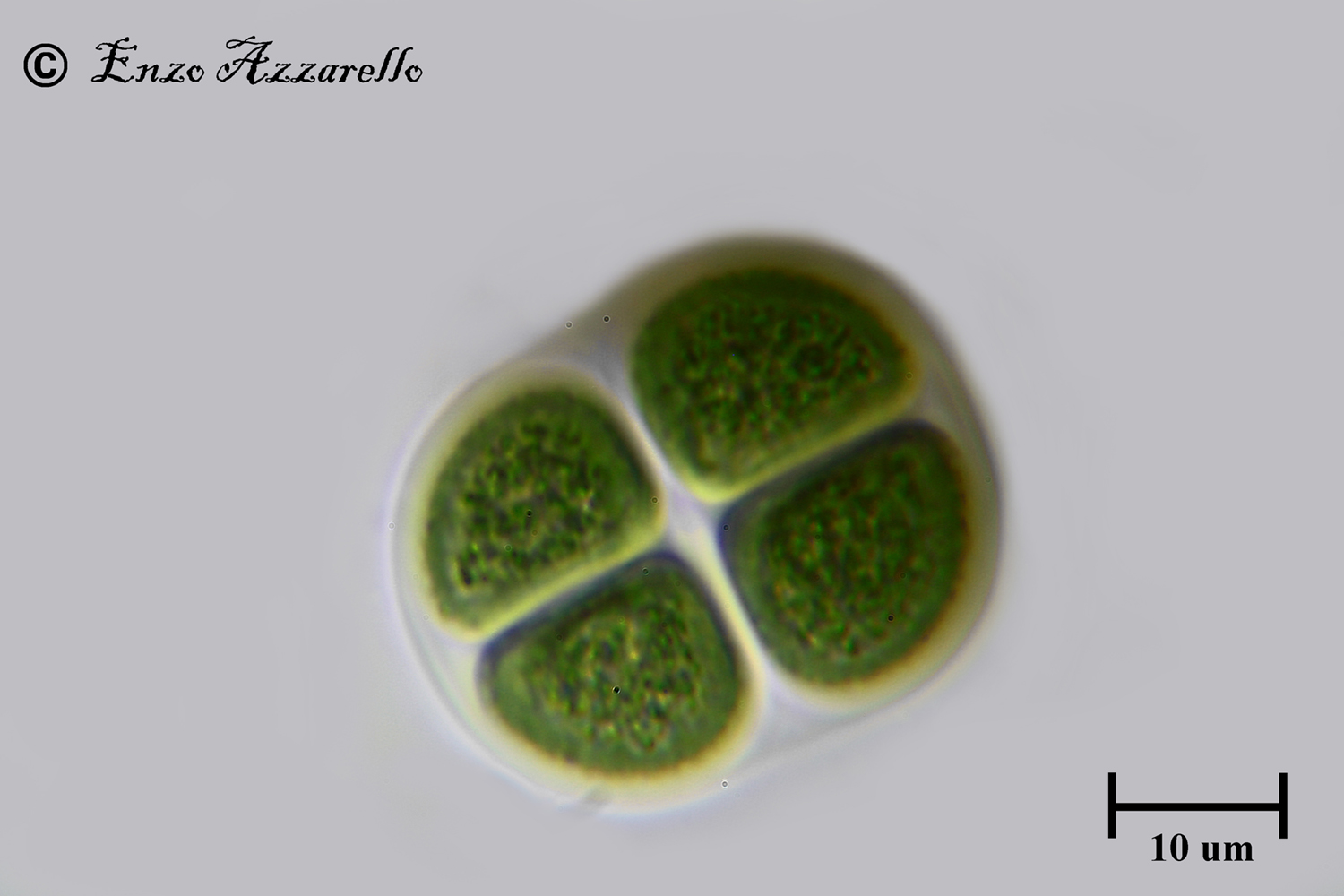 Chroococcus 1000X